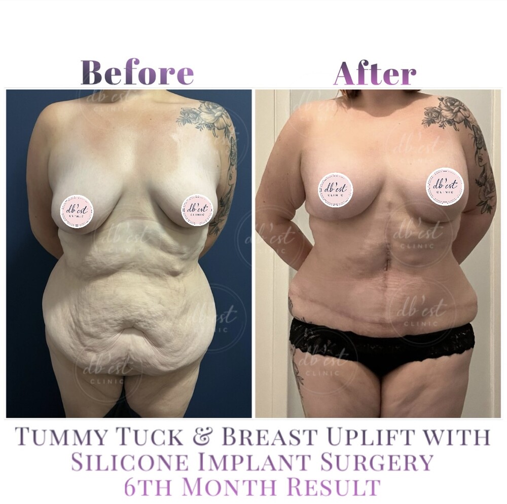 Clinic Results Gallery